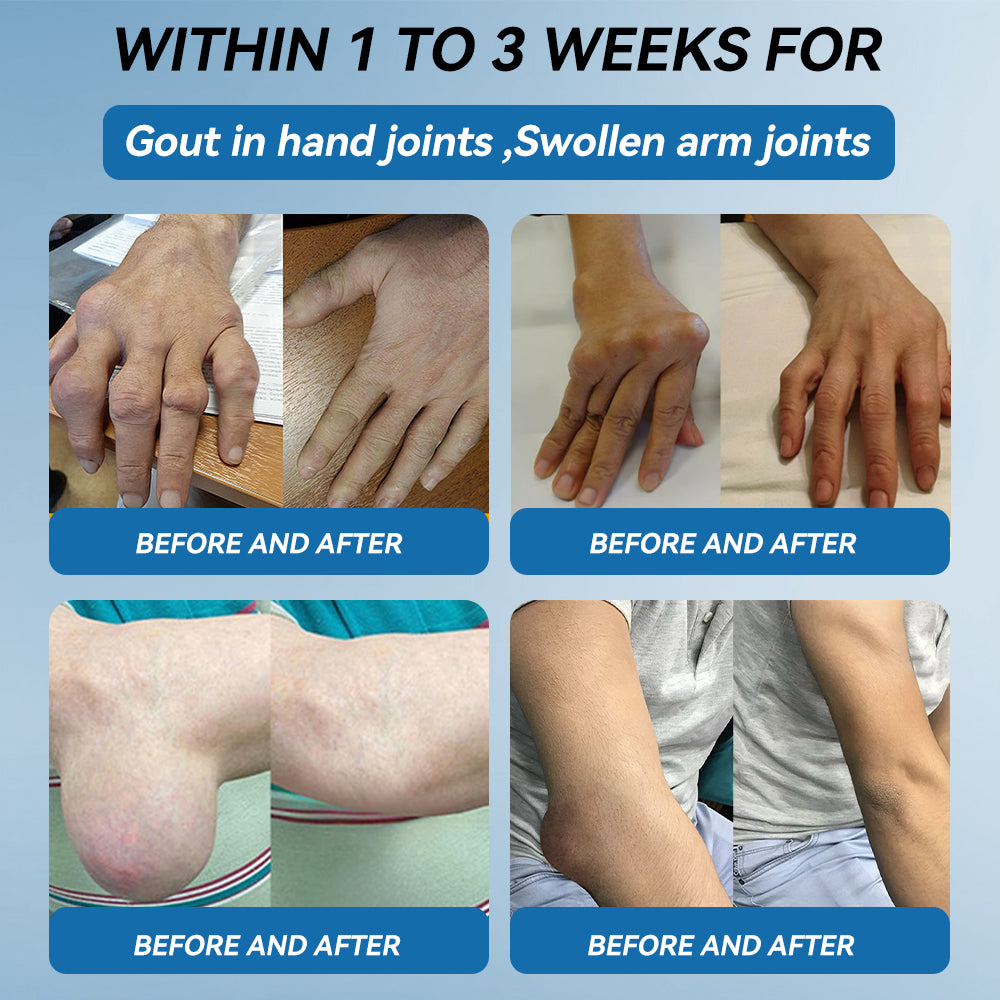 Don't miss out! Enjoy half price on all selected items for a limited time🦴𝖯𝗂𝖼𝗱𝗼® BPC-157 Joint Healing Cream - 50% Off - Today Only!